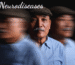 Neurodiseases